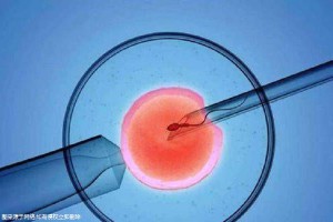 生殖中心环境